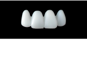 Cod.E22UPPER ANTERIOR : 15x  wax facings-bridges (hollow), MEDIUM, Tapering ovoid, (12-22), compatible with solid (not  hollow) wax bridges Cod.S22UPPER ANTERIOR, (12-22)